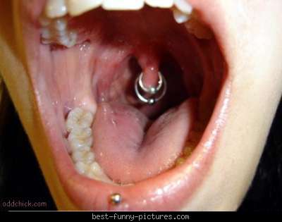  “piercings” orales causan numerosas complicaciones y lesiones 
