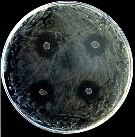 Un cultivo de la bacteria causante de la caries, sobre el que se han añadido cuatro gotas de 'Streptococcus dentisani', alrededor de las que se ha formado una especie de escudo protector contra la caries