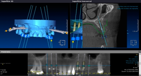 radiologia-dental-digital